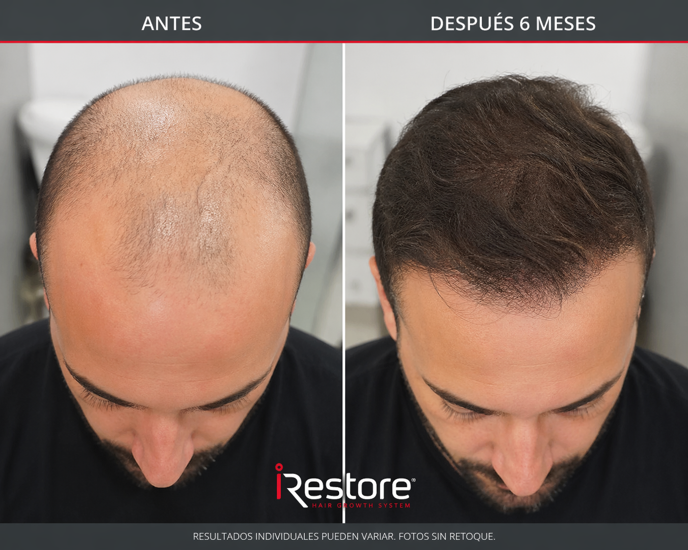 Antes y después